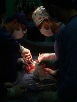 خارج کردن تومور از کلیه دختر ۹ ساله در رشت خارج کردن تومور از کلیه دختر ۹ ساله در رشت