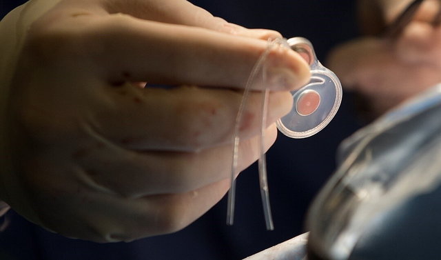 نیاز کشور به ۲۰۰۰ پروتز شنوایی طی امسال نیاز کشور به ۲۰۰۰ پروتز شنوایی طی امسال