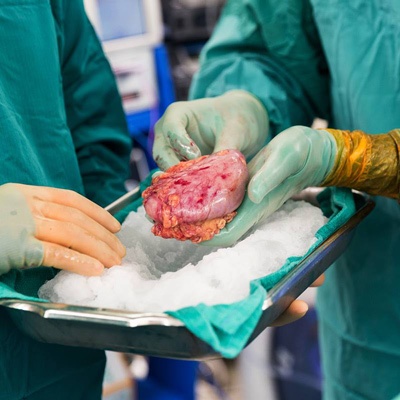 ۵۰۰ بیمار کلیوی در گیلان در انتظار پیوند ۵۰۰ بیمار کلیوی در گیلان در انتظار پیوند